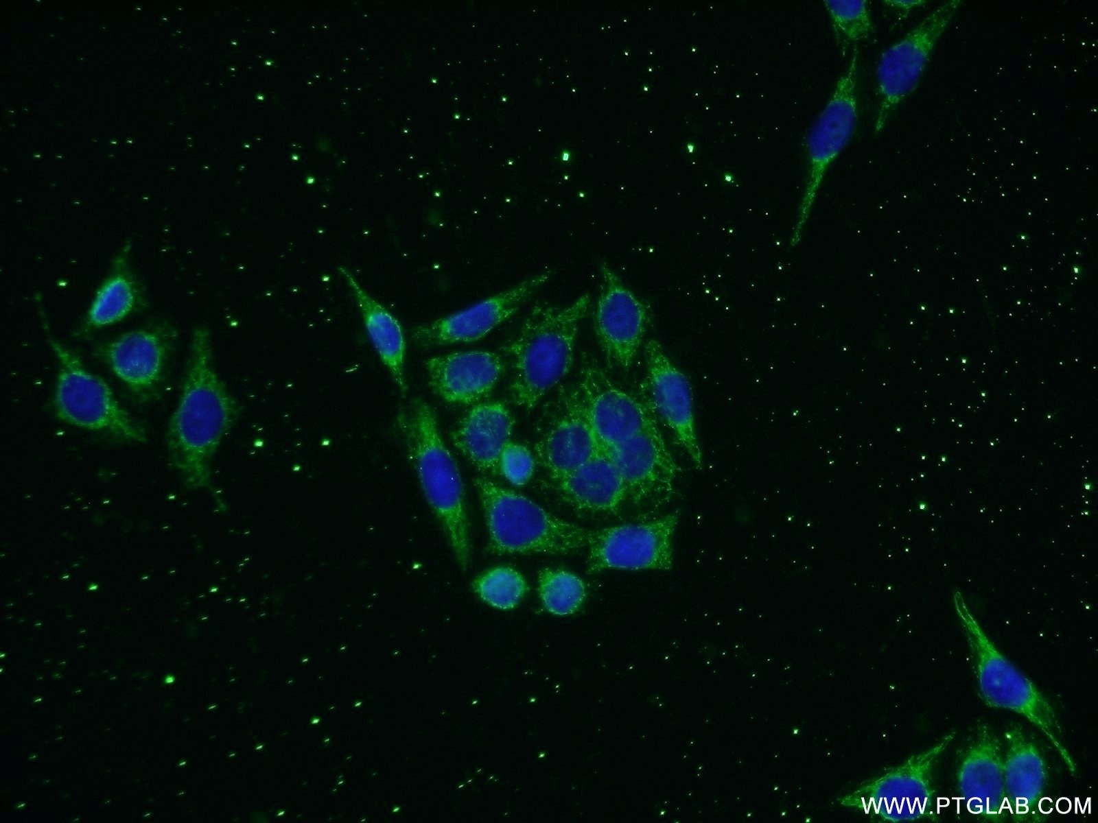 Immunofluorescence (IF) / fluorescent staining of PC-3 cells using KLHDC3 Polyclonal antibody (13905-1-AP)