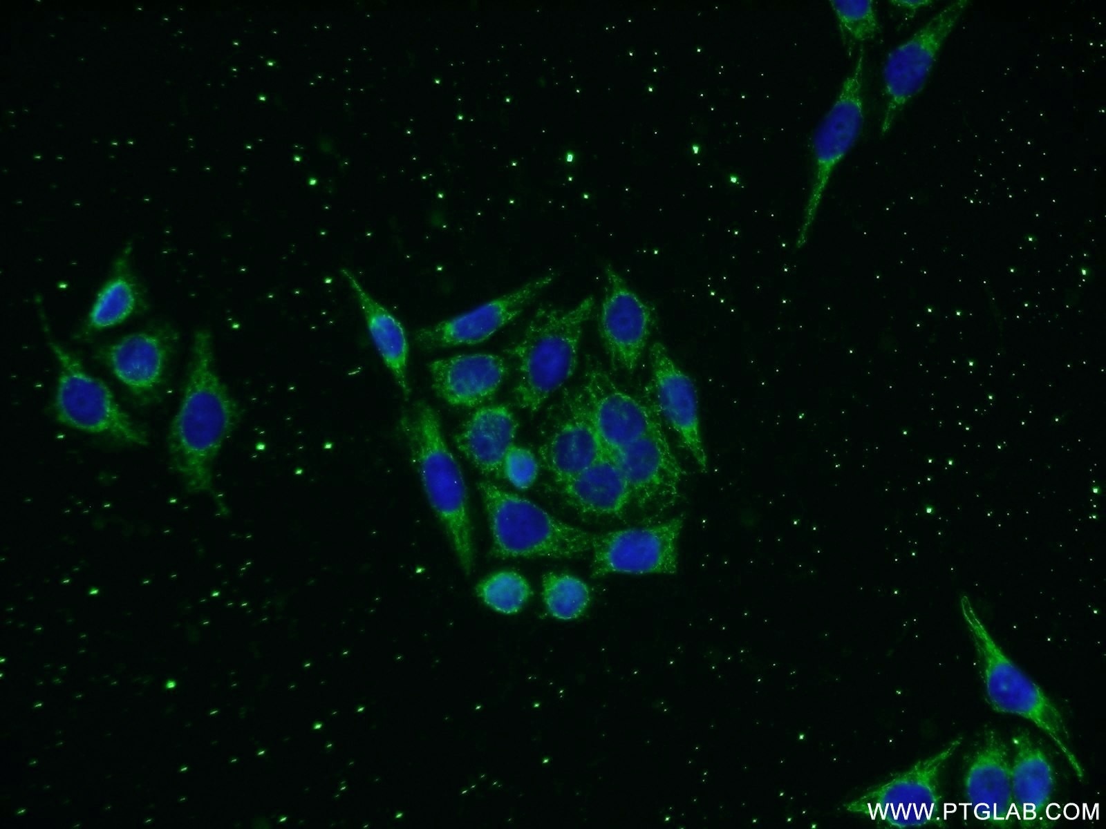 IF Staining of PC-3 using 13905-1-AP