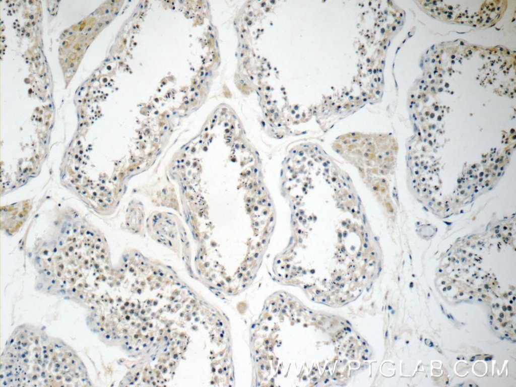 Immunohistochemistry (IHC) staining of human testis tissue using KLHDC3 Polyclonal antibody (13905-1-AP)