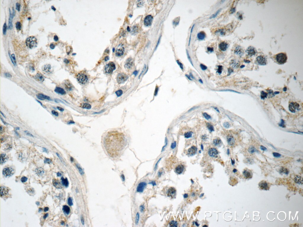 Immunohistochemistry (IHC) staining of human testis tissue using KLHDC3 Polyclonal antibody (13905-1-AP)