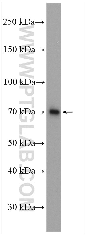 Western Blot (WB) analysis of Jurkat cells using KLHDC4 Polyclonal antibody (16915-1-AP)