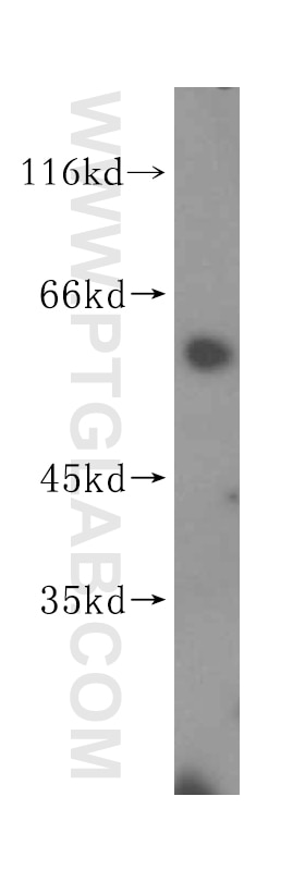 Western Blot (WB) analysis of mouse thymus tissue using KLHDC4 Polyclonal antibody (16915-1-AP)