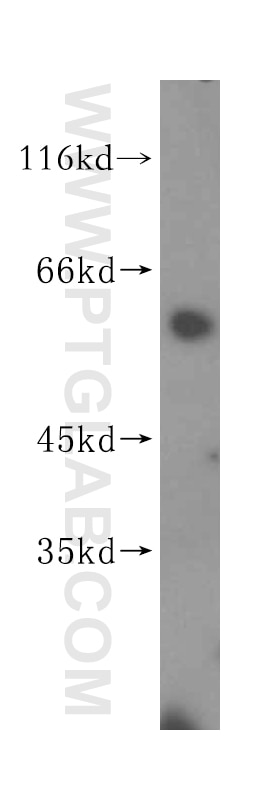 WB analysis of mouse thymus using 16915-1-AP