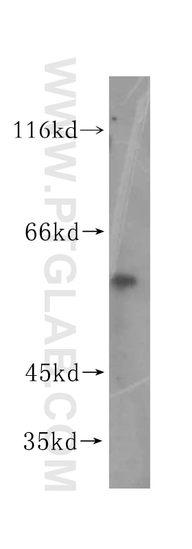 Western Blot (WB) analysis of human stomach tissue using KLHDC4 Polyclonal antibody (16915-1-AP)