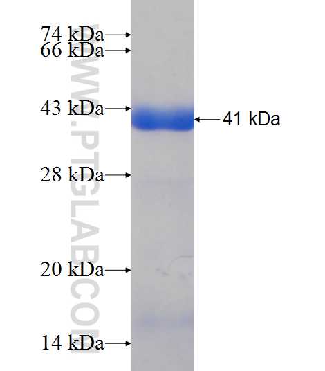 KLHDC4 fusion protein Ag9254 SDS-PAGE
