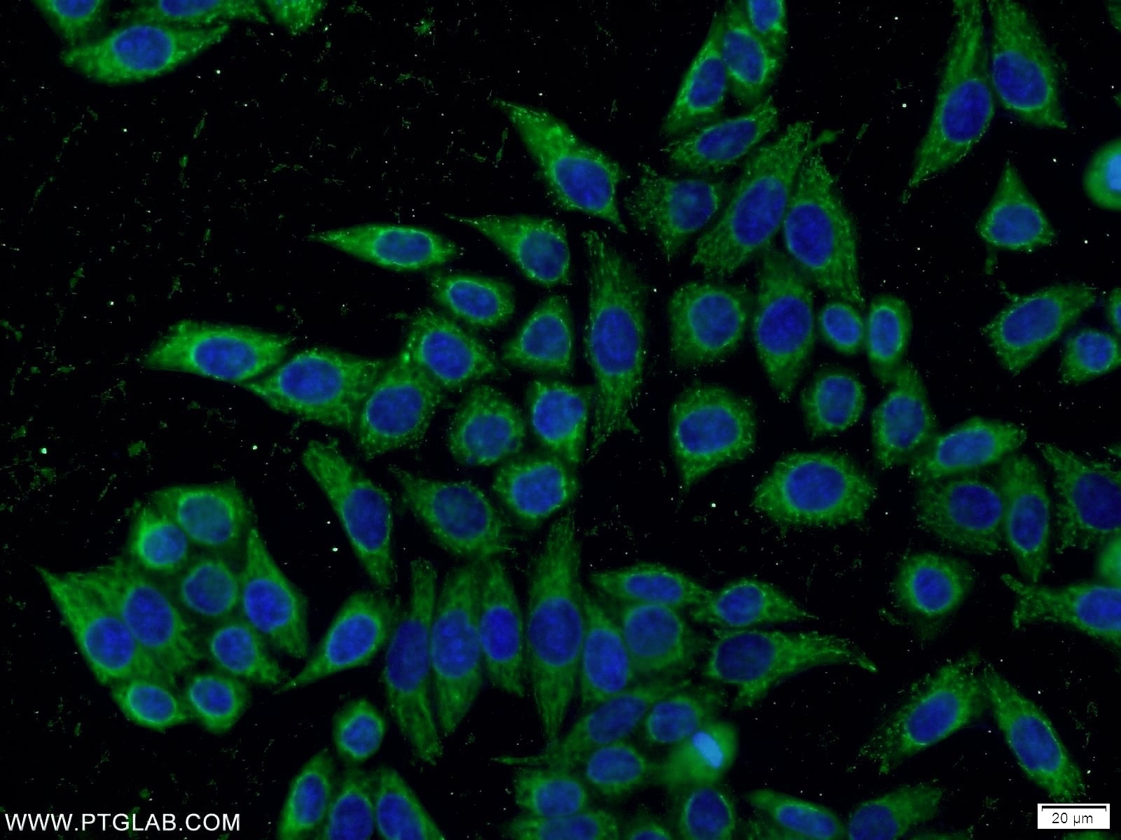 Immunofluorescence (IF) / fluorescent staining of HeLa cells using KLHDC5 Polyclonal antibody (24847-1-AP)