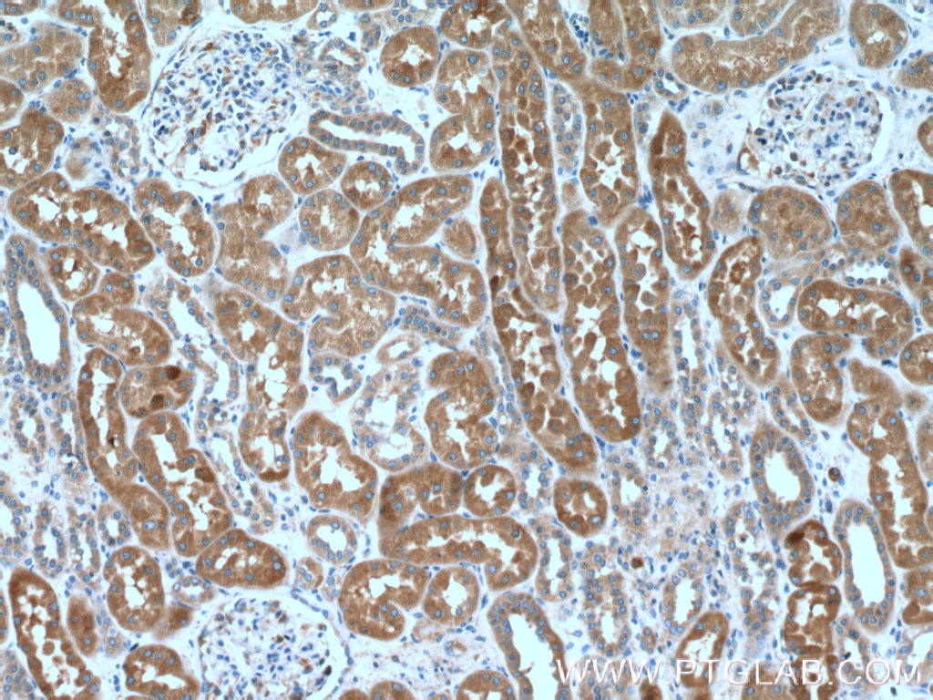 Immunohistochemistry (IHC) staining of human kidney tissue using KLHDC5 Polyclonal antibody (24847-1-AP)