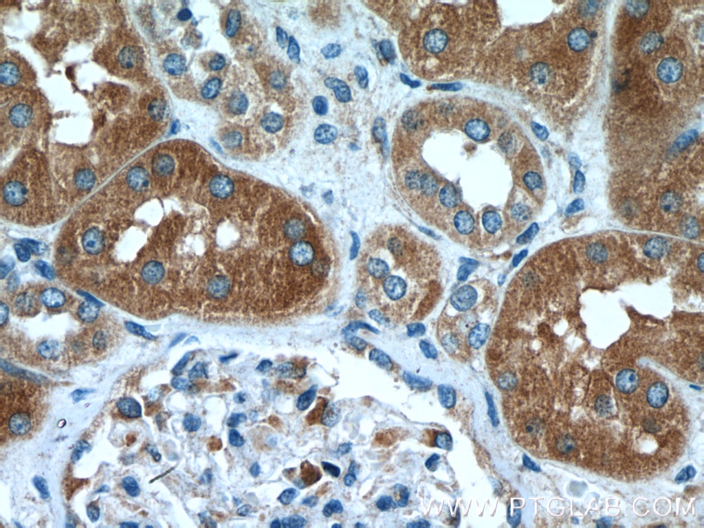 Immunohistochemistry (IHC) staining of human kidney tissue using KLHDC5 Polyclonal antibody (24847-1-AP)