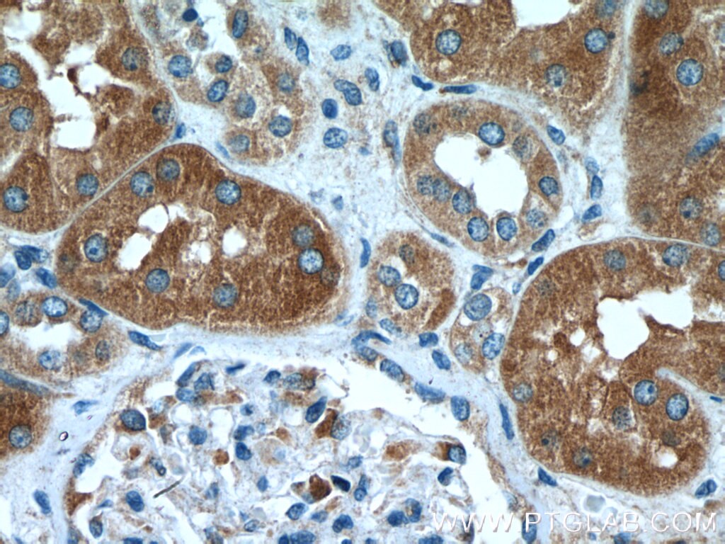 IHC staining of human kidney using 24847-1-AP