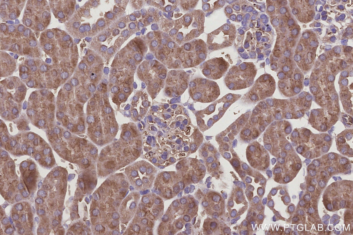 Immunohistochemistry (IHC) staining of mouse kidney tissue using KLHDC5 Polyclonal antibody (24847-1-AP)