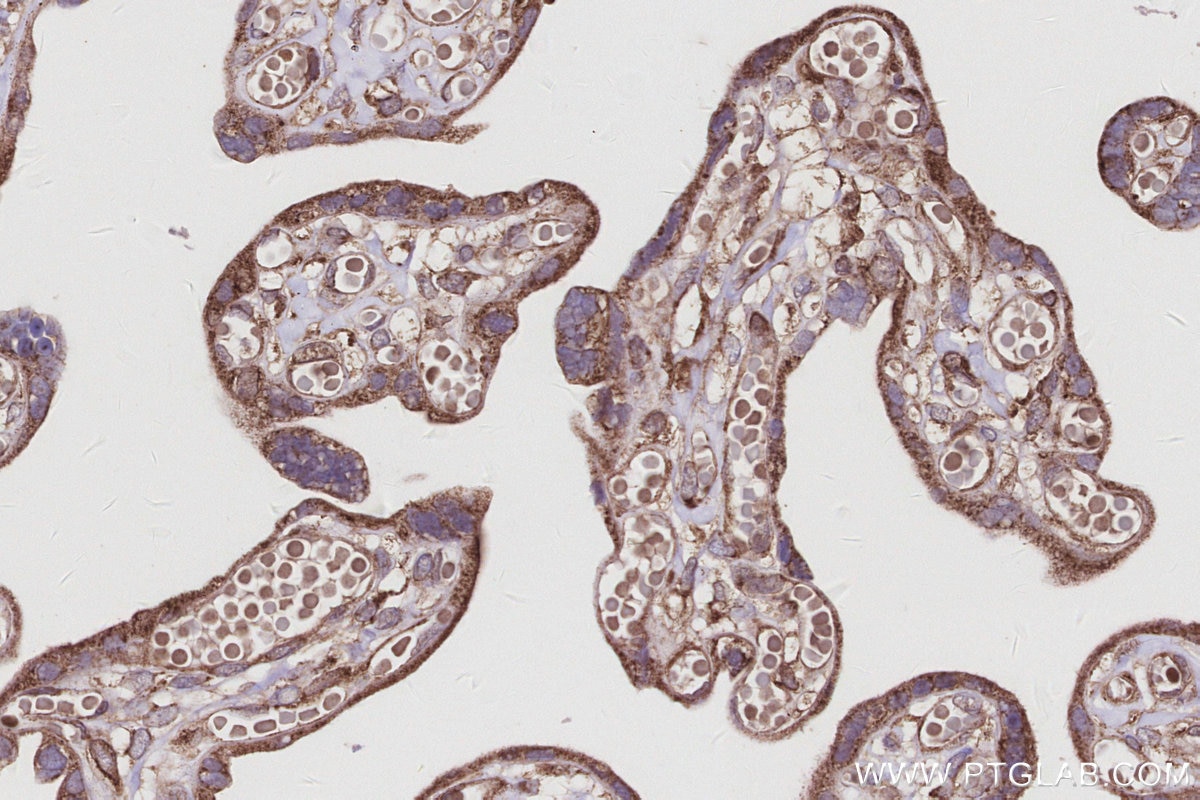 Immunohistochemistry (IHC) staining of human placenta tissue using KLHDC5 Polyclonal antibody (24847-1-AP)