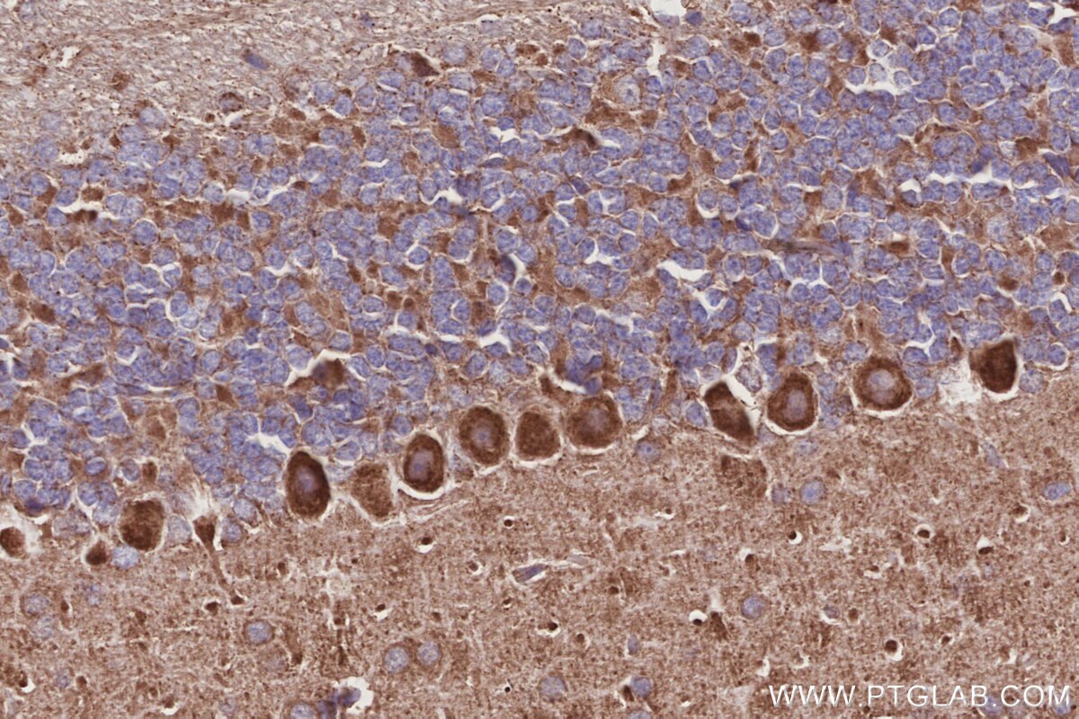 Immunohistochemistry (IHC) staining of mouse cerebellum tissue using KLHDC5 Polyclonal antibody (24847-1-AP)