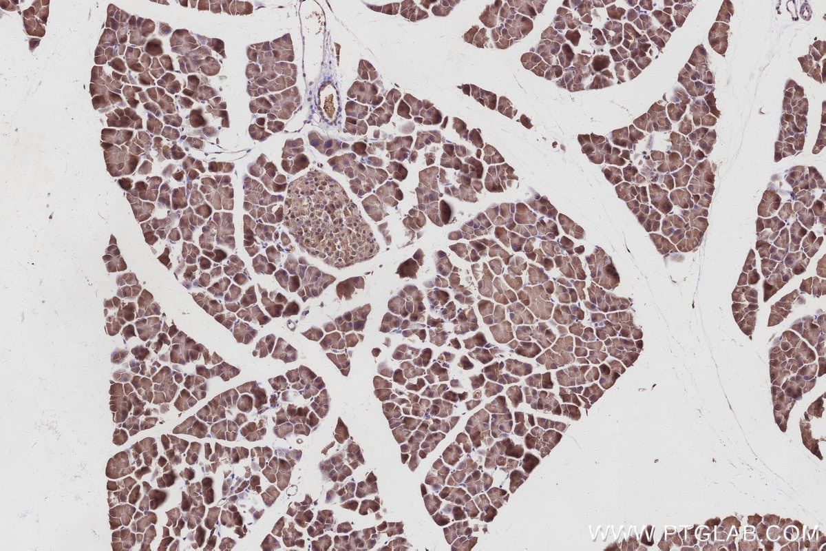 Immunohistochemistry (IHC) staining of mouse pancreas tissue using KLHDC5 Polyclonal antibody (24847-1-AP)