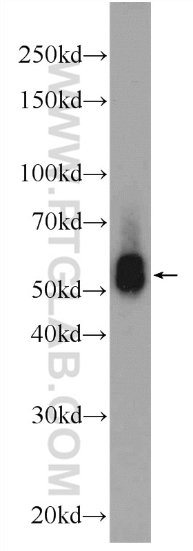 Western Blot (WB) analysis of HeLa cells using KLHDC5 Polyclonal antibody (24847-1-AP)