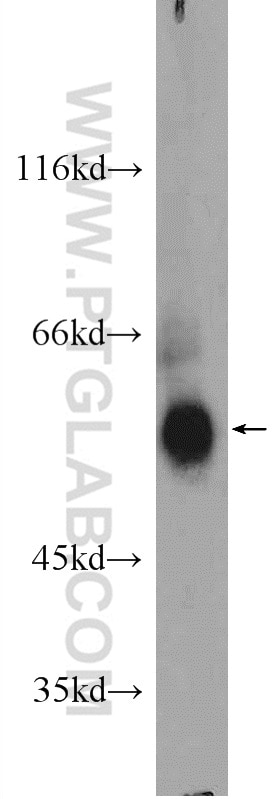 Western Blot (WB) analysis of mouse brain tissue using KLHDC5 Polyclonal antibody (24847-1-AP)