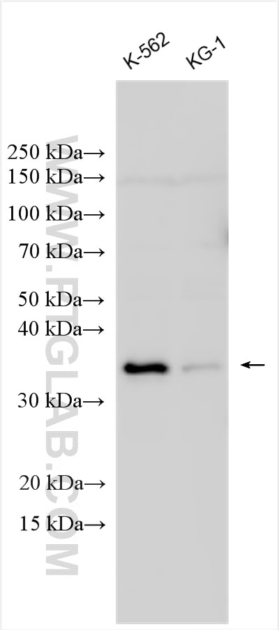 KLHDC8B