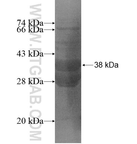 KLHDC8B fusion protein Ag15028 SDS-PAGE