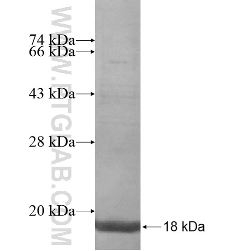 KLHDC8B fusion protein Ag15438 SDS-PAGE