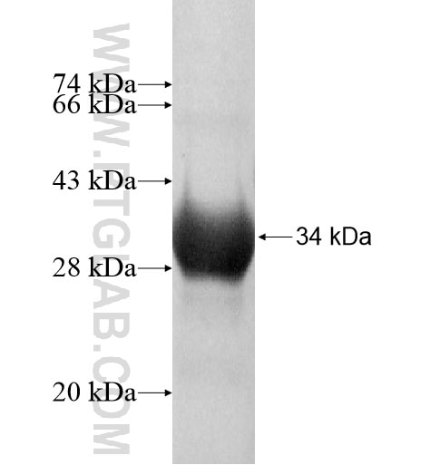 KLHDC9 fusion protein Ag10953 SDS-PAGE