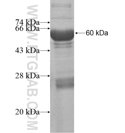 KLHDC9 fusion protein Ag10980 SDS-PAGE
