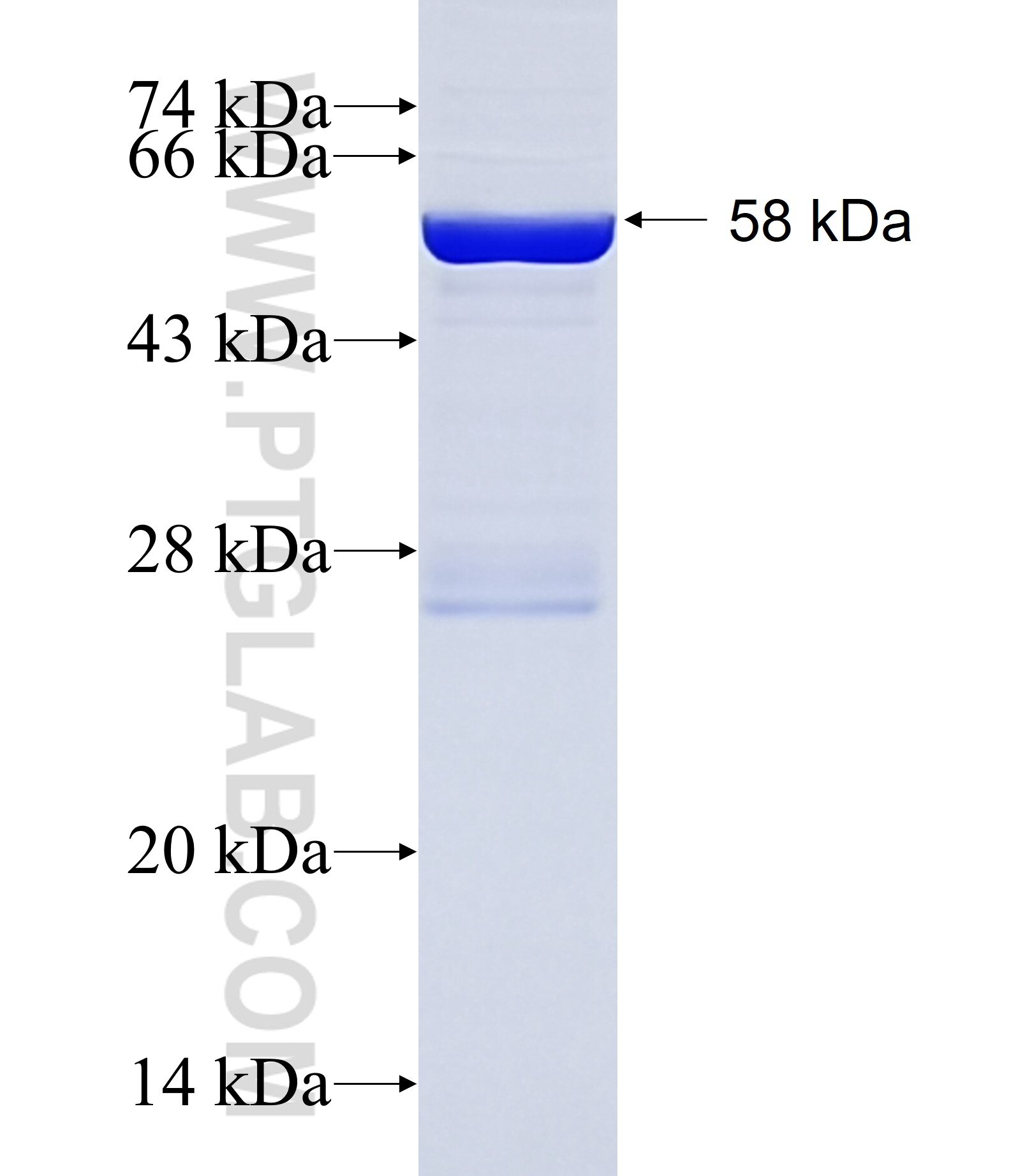 KLHDC9 fusion protein Ag10980 SDS-PAGE