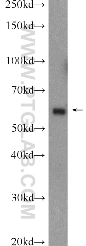 Western Blot (WB) analysis of mouse testis tissue using KLHL10 Polyclonal antibody (25591-1-AP)