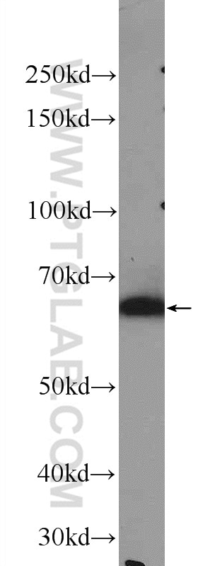 Western Blot (WB) analysis of rat testis tissue using KLHL10 Polyclonal antibody (25591-1-AP)