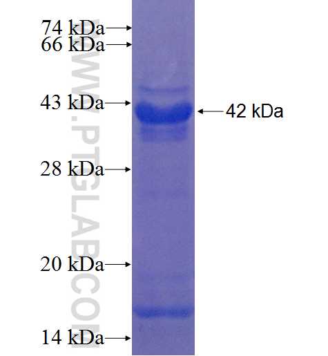 KLHL10 fusion protein Ag22368 SDS-PAGE