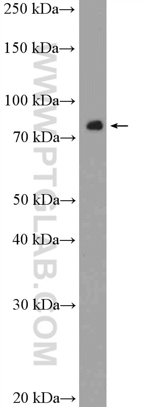 Western Blot (WB) analysis of MCF-7 cells using KLHL11 Polyclonal antibody (17117-1-AP)