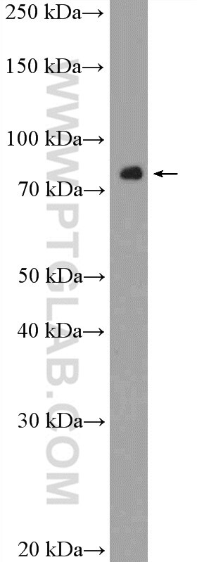 WB analysis of MCF-7 using 17117-1-AP