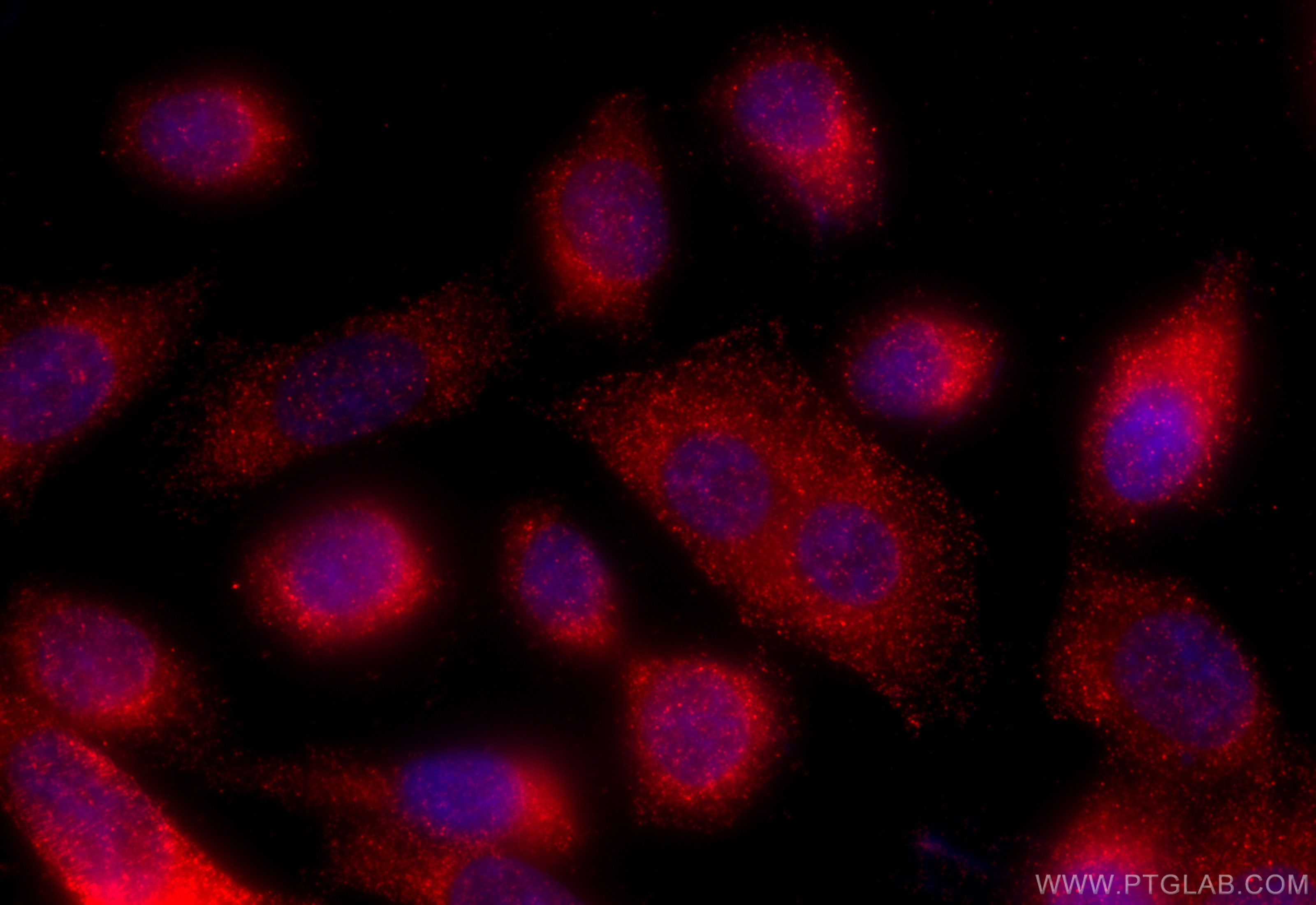 Immunofluorescence (IF) / fluorescent staining of PC-3 cells using KLHL12 Polyclonal antibody (14883-1-AP)