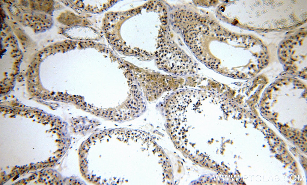 Immunohistochemistry (IHC) staining of human testis tissue using KLHL12 Polyclonal antibody (14883-1-AP)