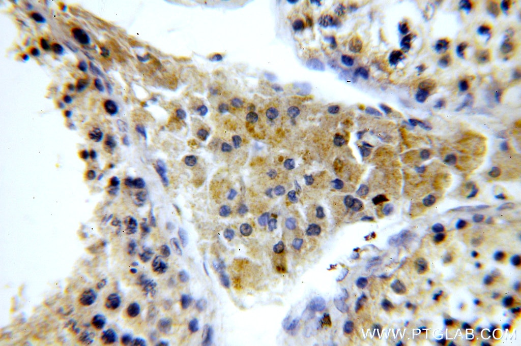 Immunohistochemistry (IHC) staining of human testis tissue using KLHL12 Polyclonal antibody (14883-1-AP)