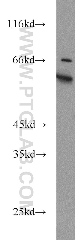 Western Blot (WB) analysis of PC-3 cells using KLHL12 Polyclonal antibody (14883-1-AP)