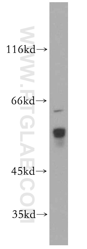 Western Blot (WB) analysis of PC-3 cells using KLHL12 Polyclonal antibody (14883-1-AP)