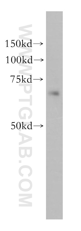 Western Blot (WB) analysis of Jurkat cells using KLHL13 Polyclonal antibody (15612-1-AP)