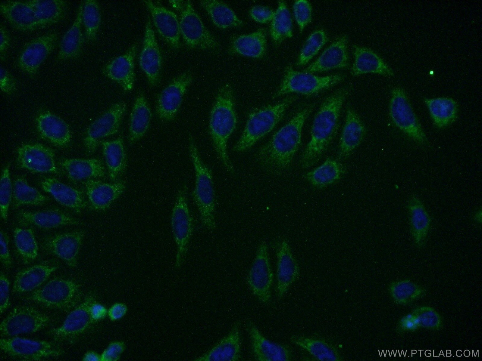 Immunofluorescence (IF) / fluorescent staining of HepG2 cells using KLHL14 Polyclonal antibody (16693-1-AP)