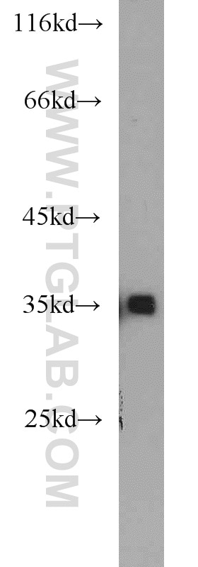 Western Blot (WB) analysis of PC-3 cells using KLHL14 Polyclonal antibody (16693-1-AP)