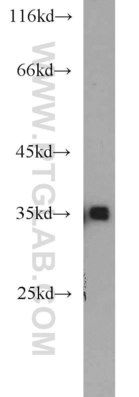 WB analysis of PC-3 using 16693-1-AP