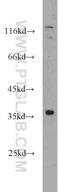 Western Blot (WB) analysis of MCF-7 cells using KLHL14 Polyclonal antibody (16693-1-AP)