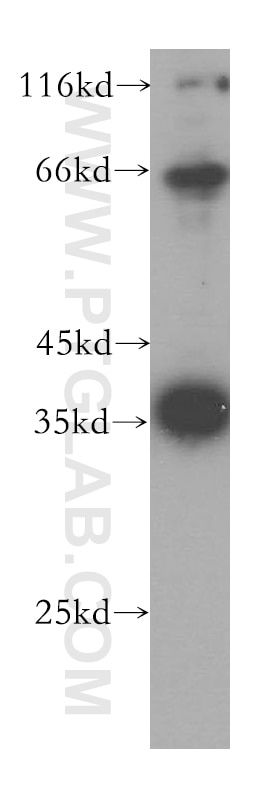 Western Blot (WB) analysis of HepG2 cells using KLHL14 Polyclonal antibody (16693-1-AP)