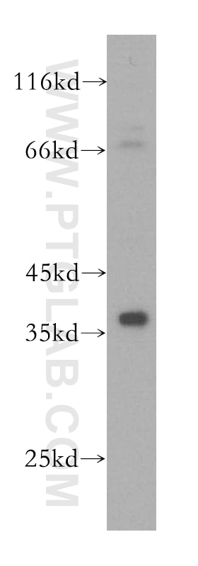 Western Blot (WB) analysis of PC-3 cells using KLHL14 Polyclonal antibody (16693-1-AP)