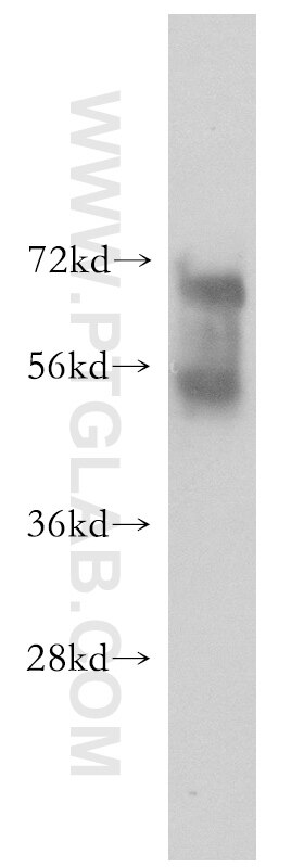 Western Blot (WB) analysis of HEK-293 cells using KLHL14 Polyclonal antibody (51131-1-AP)