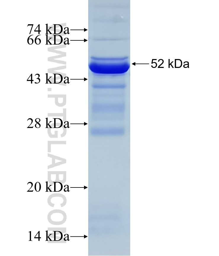 KLHL14 fusion protein Ag10065 SDS-PAGE