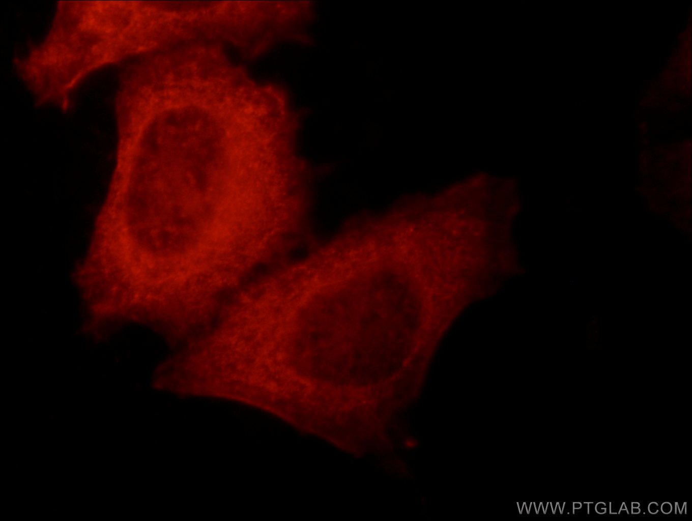 Immunofluorescence (IF) / fluorescent staining of HepG2 cells using KLHL14-Specific Polyclonal antibody (14849-1-AP)