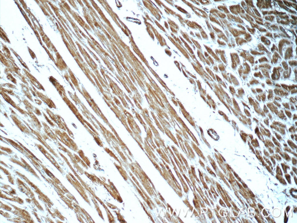 Immunohistochemistry (IHC) staining of human heart tissue using KLHL14-Specific Polyclonal antibody (14849-1-AP)