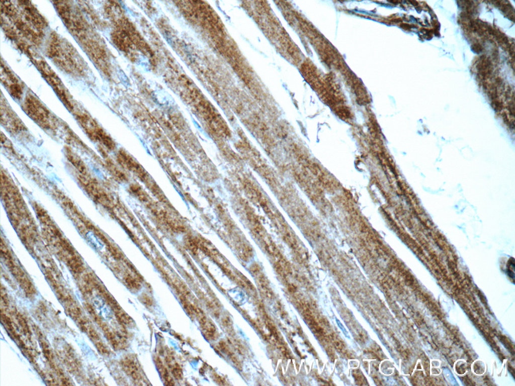 Immunohistochemistry (IHC) staining of human heart tissue using KLHL14-Specific Polyclonal antibody (14849-1-AP)