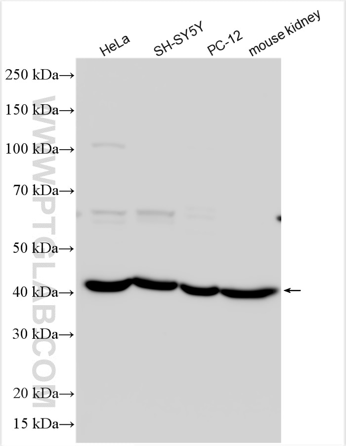 Western Blot (WB) analysis of various lysates using KLHL14-Specific Polyclonal antibody (14849-1-AP)