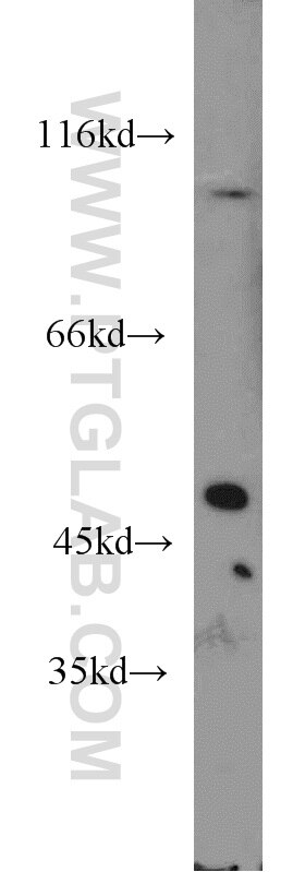 KLHL14-Specific