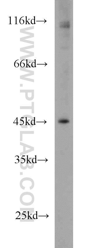 Western Blot (WB) analysis of mouse heart tissue using KLHL14-Specific Polyclonal antibody (14849-1-AP)